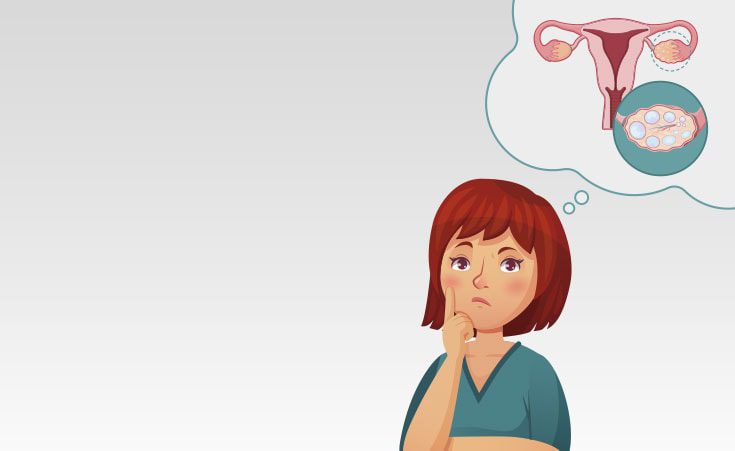 post_ovario-policistico