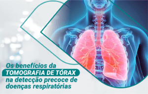 Os benefícios da Tomografia de tórax na detecção precoce de doenças respiratórias